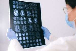 Hope in the fight against Alzheimer's - a copper-based compound